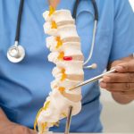 💉 Epidural Steroid Injections A Trusted Solution for Lasting Pain Relief