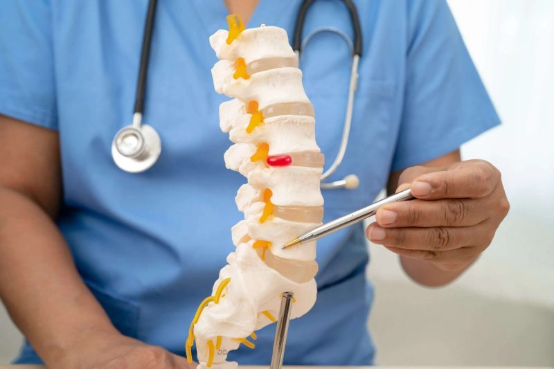 💉 Epidural Steroid Injections A Trusted Solution for Lasting Pain Relief