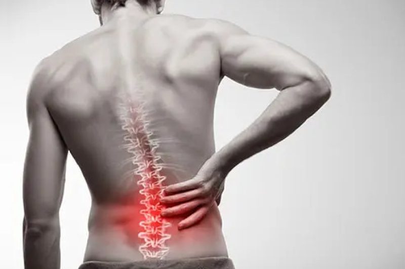 Why Your MRI Is “Normal” but Your Back Still Hurts