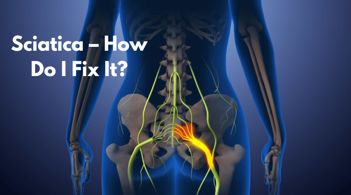 What Is Causing My Sciatica—and How Do I Fix It